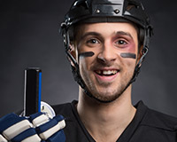 hockey player with knocked out tooth