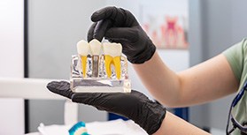 Dentist with black gloves holding model of dental implant
