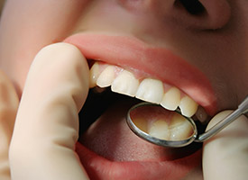 dentist checking gums