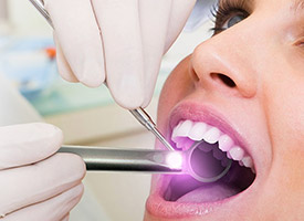 dentist using velscope on woman