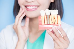 a woman smiling and showing a dental implant